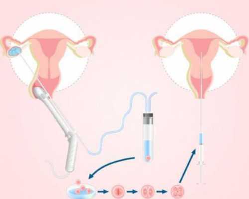 正规供卵机构名单，选择合适的借卵生子机构