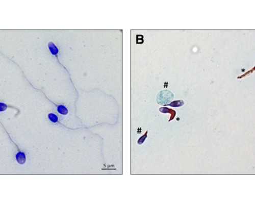 东莞助孕机构指南：试管婴儿技术详解与条件解析|