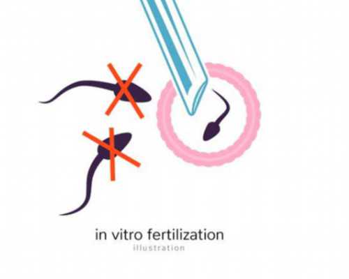 解析试管婴儿诊疗费用与技术实力